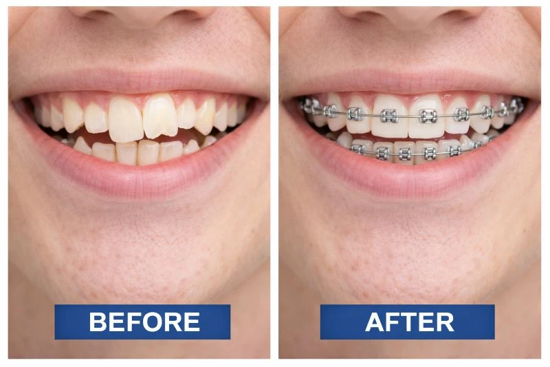 Before After