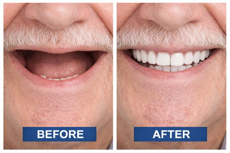Before After