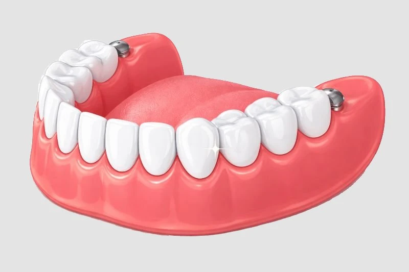 Dentures